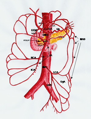 Vascular Rarea Vascular Diseases – AVE Clinics